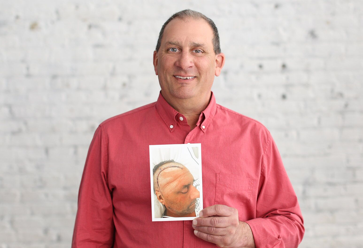 Steve Calzolano holding a photo of himself after surgery